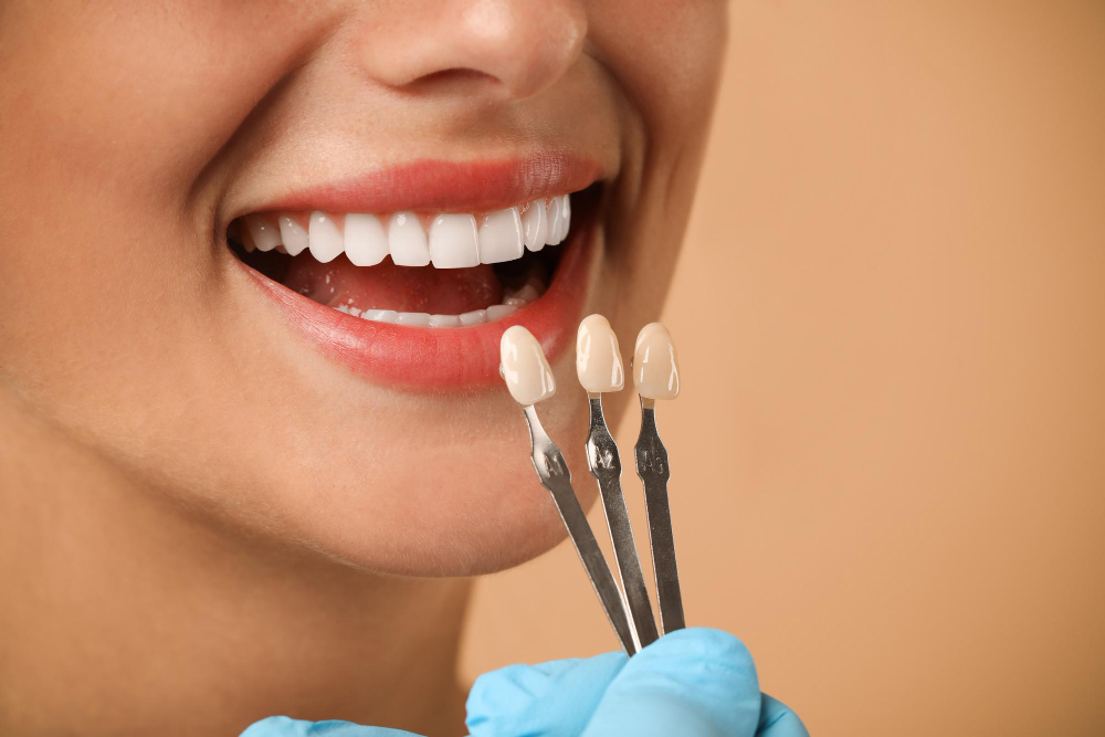 Dental Checkup